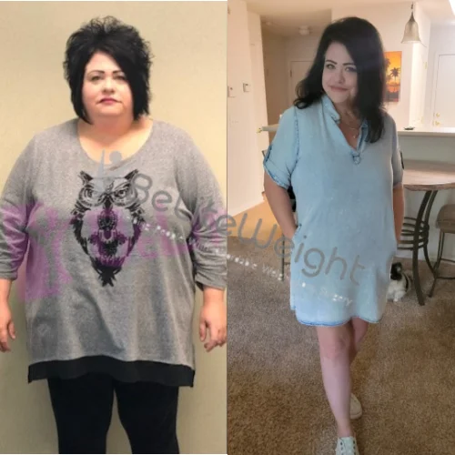 Tina W - 2 Year Update*